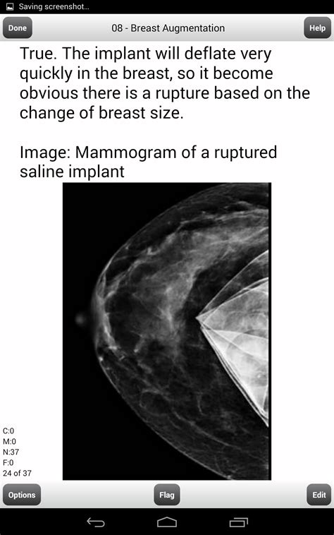 ardms breast exam